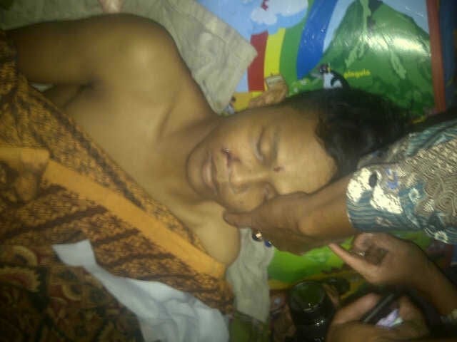 Korban Edwar saat berada di rumah duka